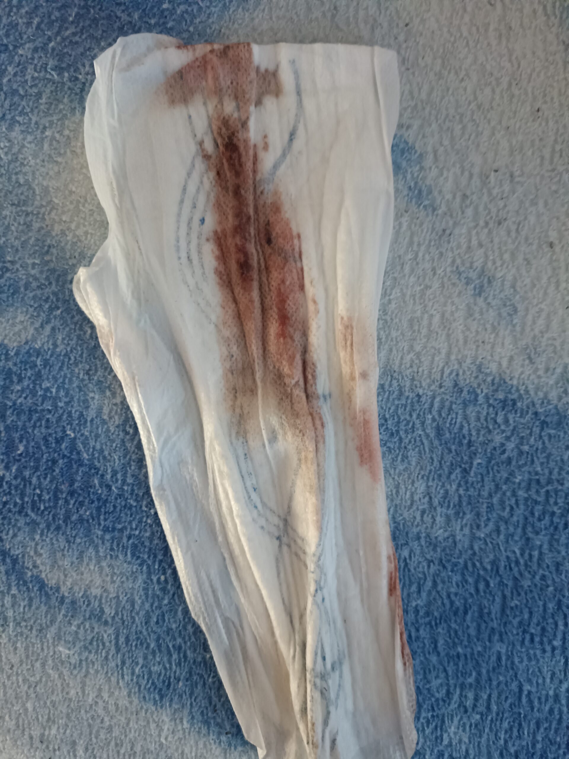 Vložka z 1.dne menstruace